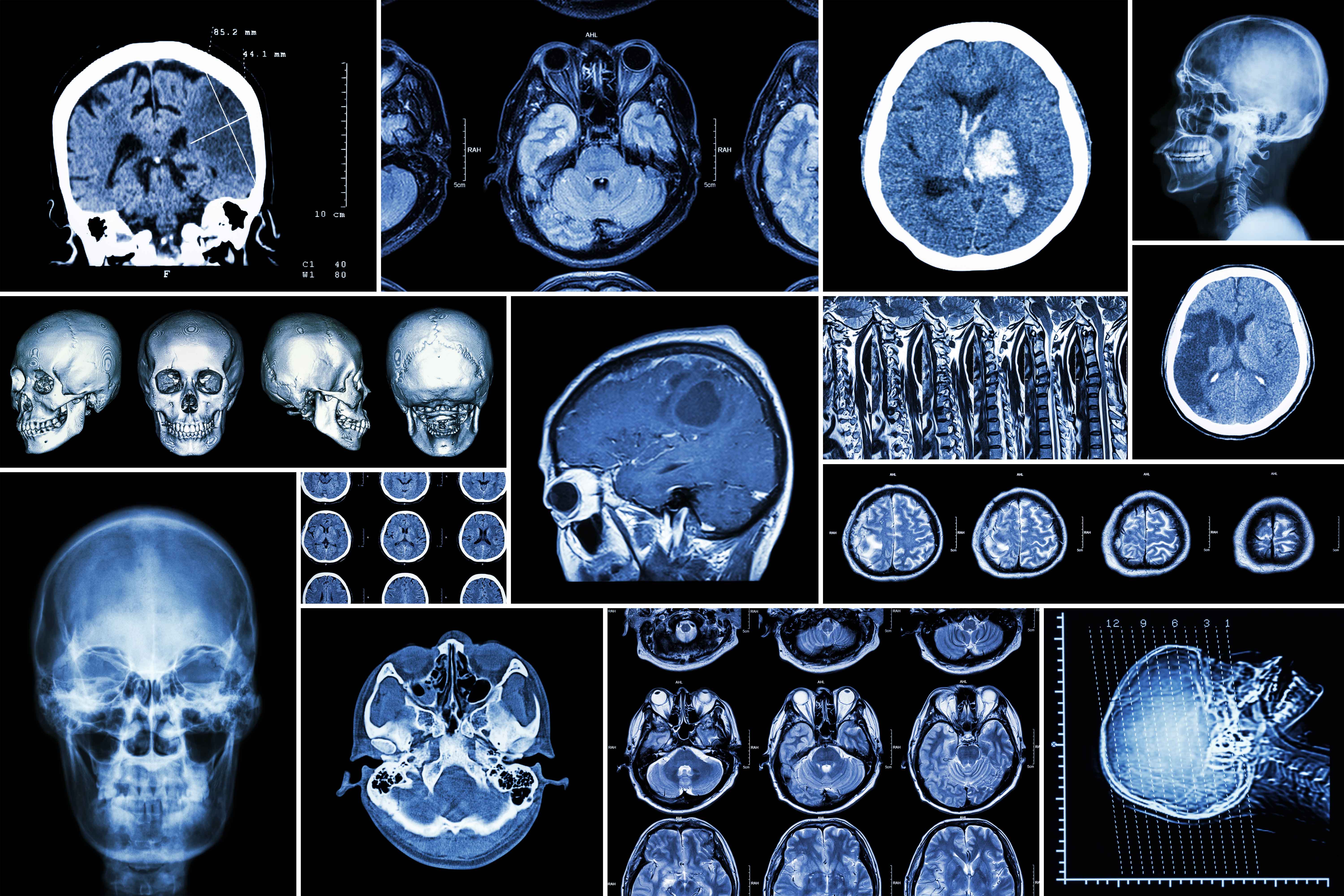 research medical imaging techniques